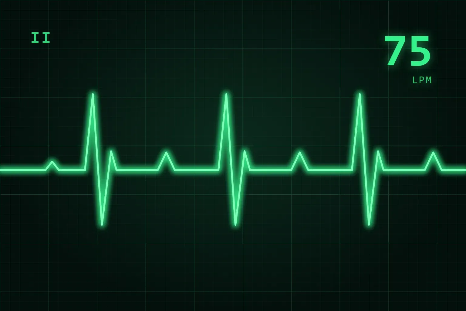 Cómo leer un electrocardiograma (ECG) en enfermería: ritmos y señales de alarma