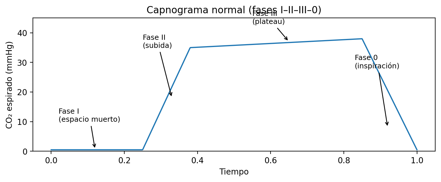 Capnograma normal con fases I–II–III–0